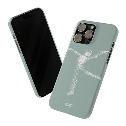 Bone-a-Rina | Coque slim durable et anti-chocs avec Design de Squelette Ballerine
