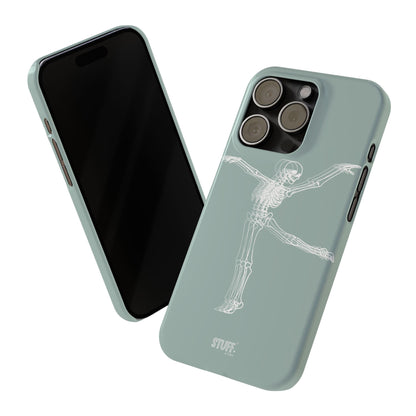 Bone-a-Rina | Coque slim durable et anti-chocs avec Design de Squelette Ballerine